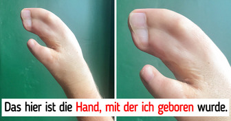 15 Personen mit außergewöhnlichen körperlichen Merkmalen, die sie aus der Masse herausheben