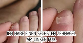 14 Menschen, denen Mutter Natur ein besonders Geschenk gemacht hat