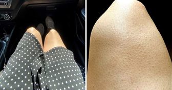 9 Körpermerkmale bei Frauen, die grundlos als Makel angesehen werden