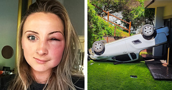 20 Pechvögel, die sich garantiert gefragt haben, “Warum ich?”