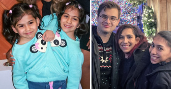 Siamesische Zwillinge verraten, wie sie ihre persönlichen Leben führen und auch, wie es mit romantischen Beziehungen abläuft