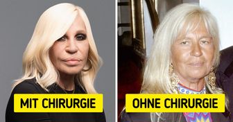 So würden 10 Prominente aussehen, wenn sie natürlich gealtert wären, ohne plastische Chirurgie