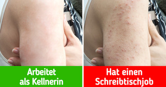 Was mit deinem Körper passieren kann, wenn du zu viel sitzt