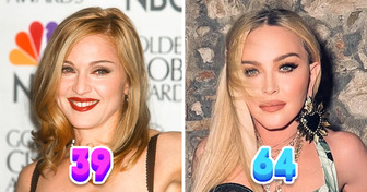 Gabeln gegen Falten? Diese und andere Geheimnisse hinter Madonnas jugendlicher Ausstrahlung