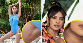 9 Körpermerkmale, über die sich Frauen des 21. Jahrhunderts nicht mehr unsicher fühlen sollten