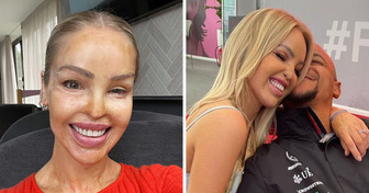 Ein Stalker spritzte Katie Piper Säure ins Gesicht. Nach 400 Operationen und öffentlicher Ablehnung lernte sie, sich selbst zu lieben und gründete eine Familie