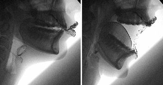 8 Unglaubliche Dinge, die beweisen, dass unser Körper das am besten durchdachte System der Welt ist