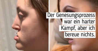 15 Menschen, die ihr Gesicht verändert haben und nun wie jemand ganz anderes aussehen