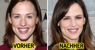 17 Promis, die ihre Zähne korrigiert haben und jetzt noch heller strahlen