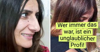 20+ mutige Frauen, die sich sagten: “Es reicht!” und sich einer Schönheitsoperation unterzogen