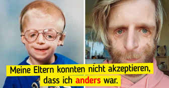 Ein Baby wurde wegen seines Aussehens ausgesetzt, und 37 Jahre später wurde er ein erfolgreiches Model und Motivator