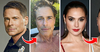 14 Promis, die sich trauten, unbearbeitete Fotos zu veröffentlichen