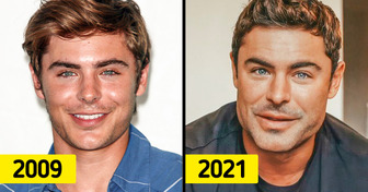 “Ich bin fast gestorben”: Zac Efron erklärt, was wirklich mit seinem Gesicht passiert ist und reagiert auf Gerüchte über plastische Chirurgie