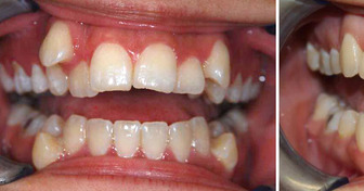 16 Menschen, deren Verwandlung uns aus den Socken gehauen hat