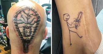 15 Menschen, die mit wunderbaren Tattoos ihre Narben überdeckt haben