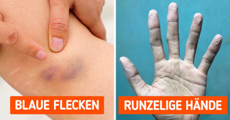 11 wichtige Alarmzeichen, die dir dein Körper gibt