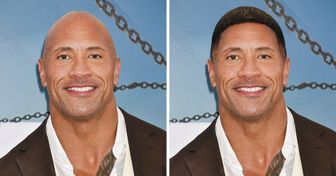 So sähen 14 Prominente aus, wenn sie keine Glatze hätten