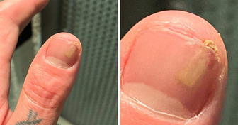 15+ Menschen, die ein bisschen Glück gebrauchen könnten