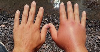 10 Arten, wie das Wetter deinen Körper wirklich beeinflussen kann