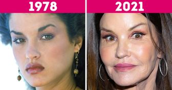20 Gegenüberstellungen von Fotos, die zeigen, wie sich die Gesichter der Supermodels im Laufe der Jahre verändert haben