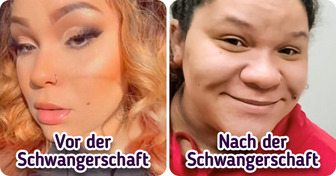 “2 verschiedene Menschen”: Eine 24-jährige Frau bekommt eine extreme “Schwangerschaftsnase”, und die Leute erkennen ihr Gesicht nicht wieder