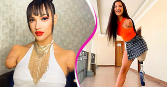 Sie verlor als Kind drei Gliedmaßen und ist heute ein erfolgreiches Model