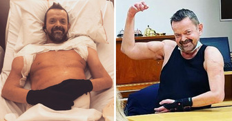 Ein Mann, dessen Arme und Schultern amputiert wurden, kann wieder winken