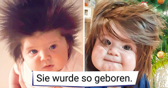 17 Menschen, die einen besonderen Segen von Mutter Natur erhalten haben