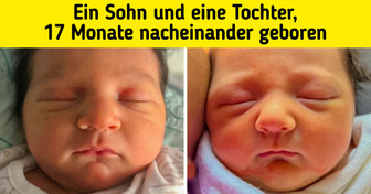 15 Male, in denen uns Genetik einfach die Sprache verschlagen hat