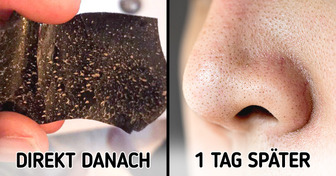 6 Dinge, die du vor der Nutzung von Nasenstrips wissen solltest