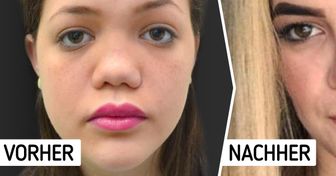 20+ Frauen ließen nur eine Kleinigkeit machen, aber die Wirkung ist enorm