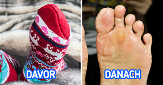 Was passieren kann, wenn du mit Socken schläfst