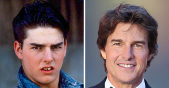 7 Prominente, die ihr Aussehen mit etwas Make-up revolutioniert haben