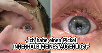 21 Menschen, die das Unglück als Banner und Muttermal tragen