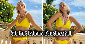 15 Menschen, deren Körper seltene Merkmale aufweisen