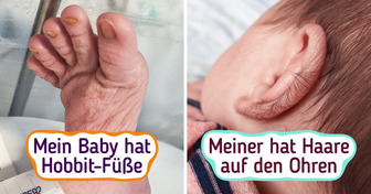17 Babys, die geboren wurden, um sich von der Masse abzuheben
