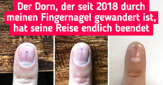 18 Menschen, die etwas gesehen haben, das seltener ist, als einen Sechser im Lotto zu haben