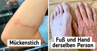 15 Menschen, die auf eine ganz besondere Art einzigartig sind