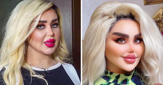 Ich hatte 43 kosmetische Eingriffe, um wie eine Barbie auszusehen, doch die Kritiker sagen, ich sehe aus wie ein “Zombie”