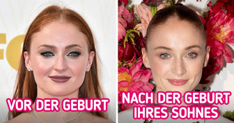 15 Promis, die nach der Geburt buchstäblich aufblühten