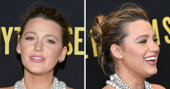 15 Fotos von Prominenten, die nicht ihre Schokoladenseite zeigen