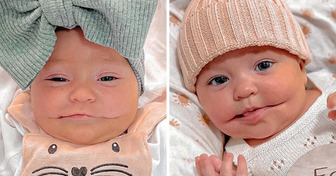 Die kleine Ayla, das Baby, das immer lächelt, verzaubert alle mit ihrer seltenen Munderkrankung