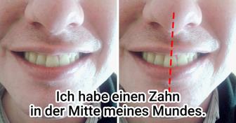 15+ seltene Körpermerkmale, die die meisten Menschen nicht haben