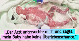 So sieht das Baby aus, das mit fünf Monaten geboren wurde und ein halbes Kilo wiegt