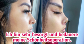 16 Menschen, die sich zu kosmetischen Eingriffen entschlossen haben, die nicht optimal verlaufen sind