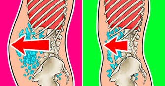 So reduzierst du Blähungen