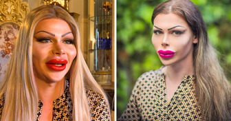 Ich habe 73.000 Dollar für Operationen ausgegeben und habe auch nicht vor, bald damit aufzuhören