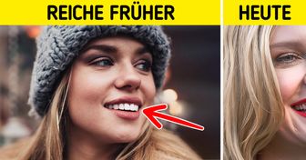 14 Beauty-Verfahren, die gestern beliebt waren, aber von denen heute alle abraten