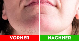 9 Einfache Wirkstoffe um Gesichtsbehaarung loszuwerden