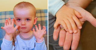 18 Bilder, die beweisen, dass die Natur immer ein Ass im Ärmel hat